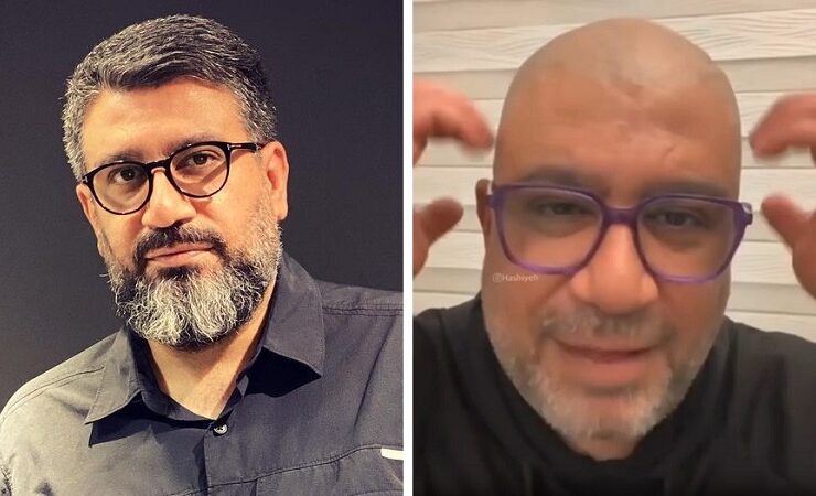 چرا رضا رشیدپور کچل شد؟ + فیلم چرا رضا رشیدپور کچل شد؟ + فیلم