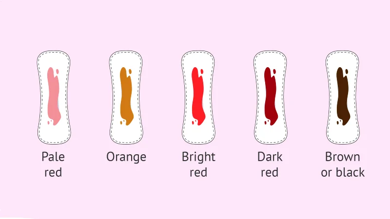 پریود یا قاعدگی چیست؟ راهنمای کامل عادت ماهانه، علائم و دلایل تأخیر 4 عقب افتادن پریود