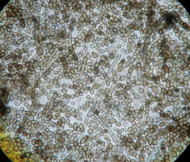 El hongo de Chernobyl y el secreto de la radiosíntesis El hongo de Chernobyl y el misterio de la radiosíntesis